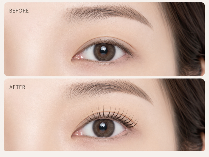 Before and After